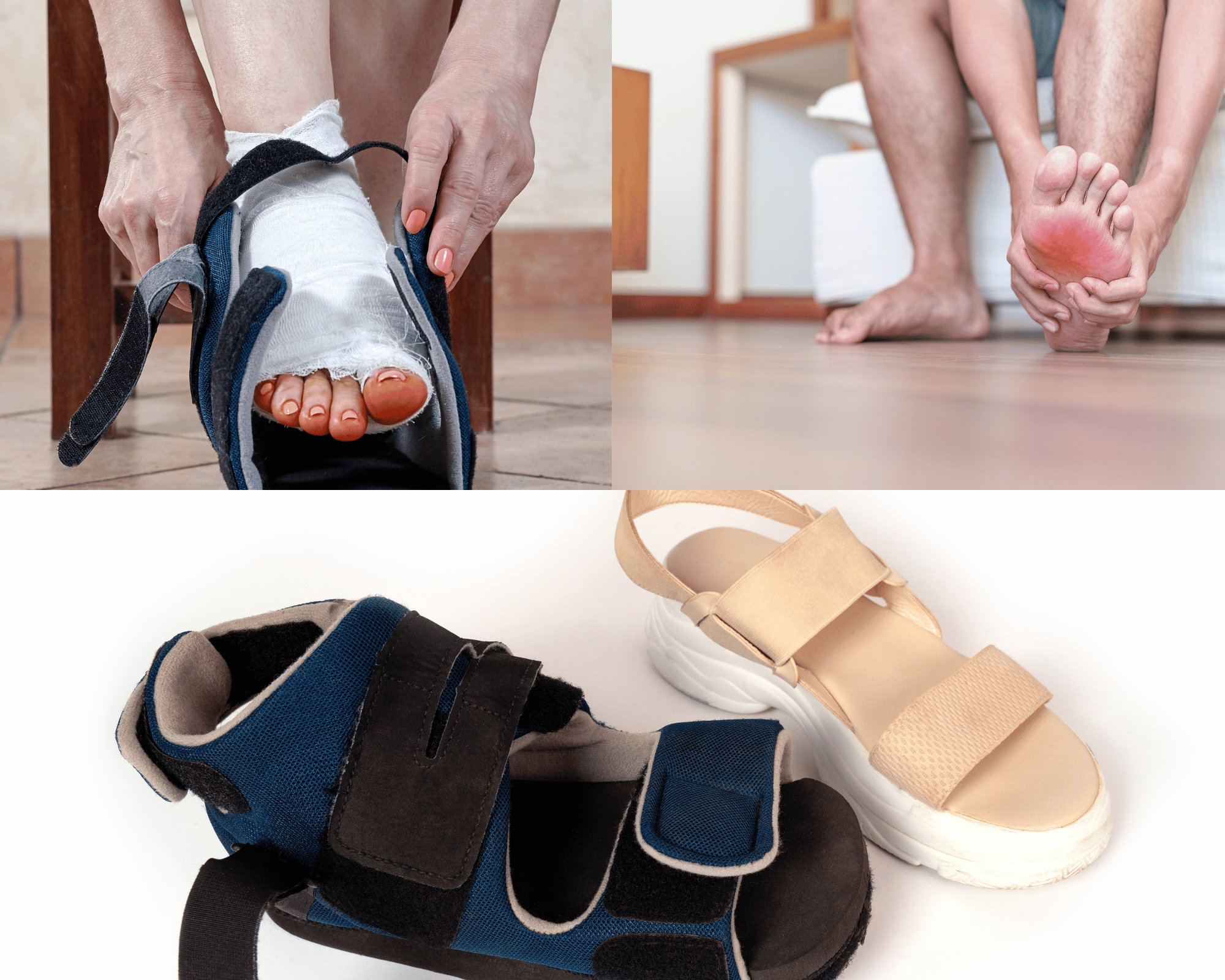 Staying Fit After Bunion Surgery: A Comprehensive Guide