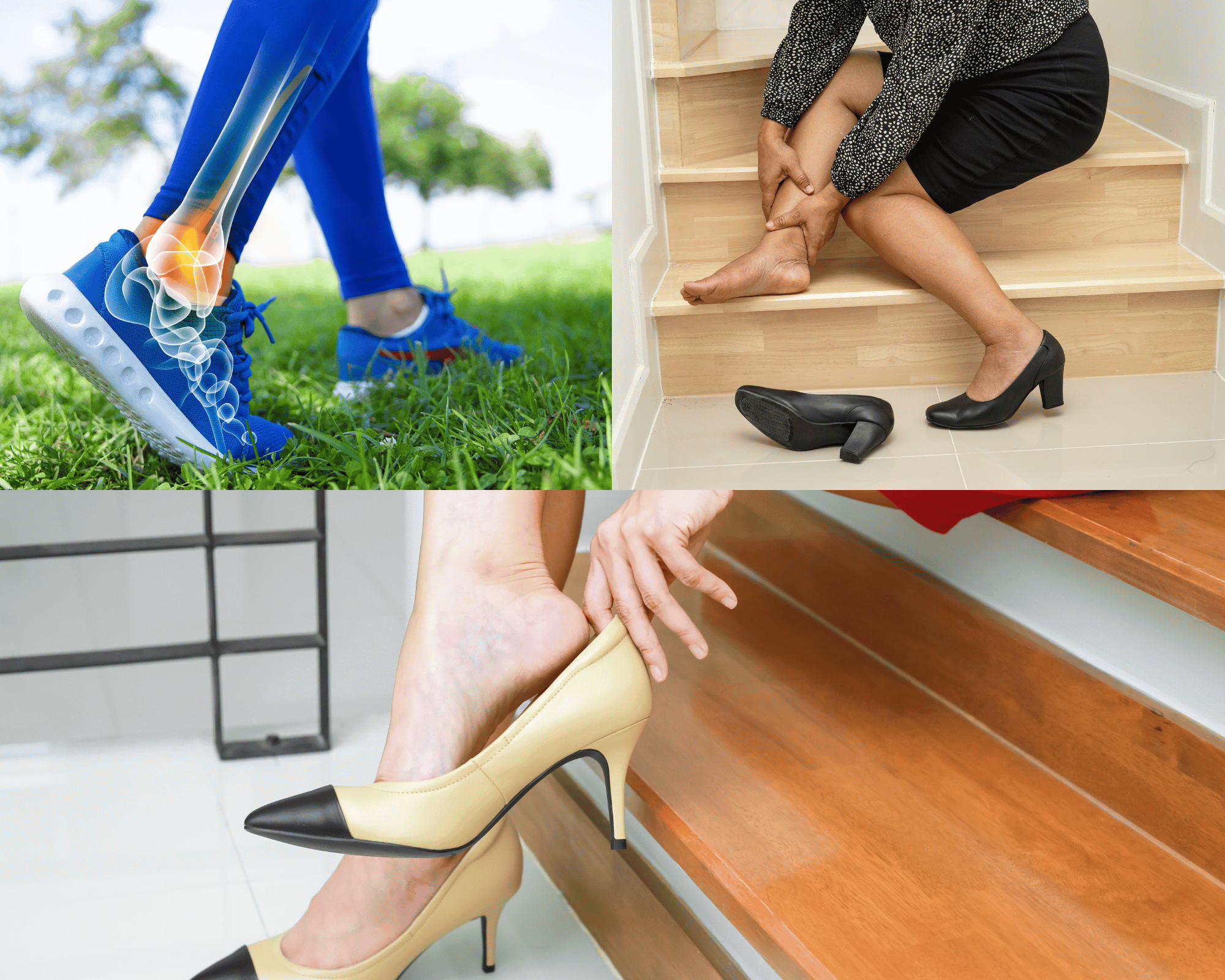 Best Shoes for Bone Spurs Foot Pain Solutions