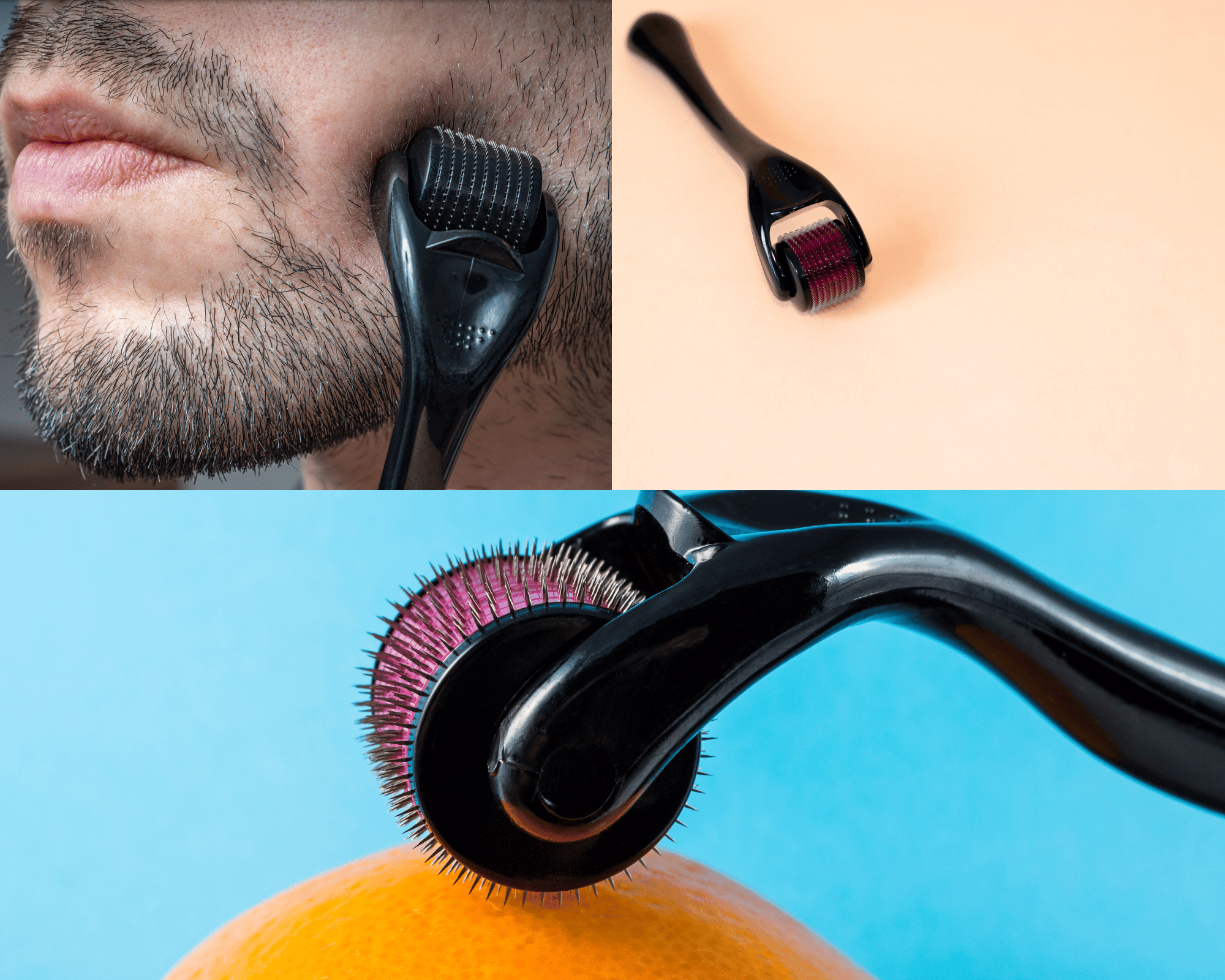 Discover the Top Beard Derma Roller Brands