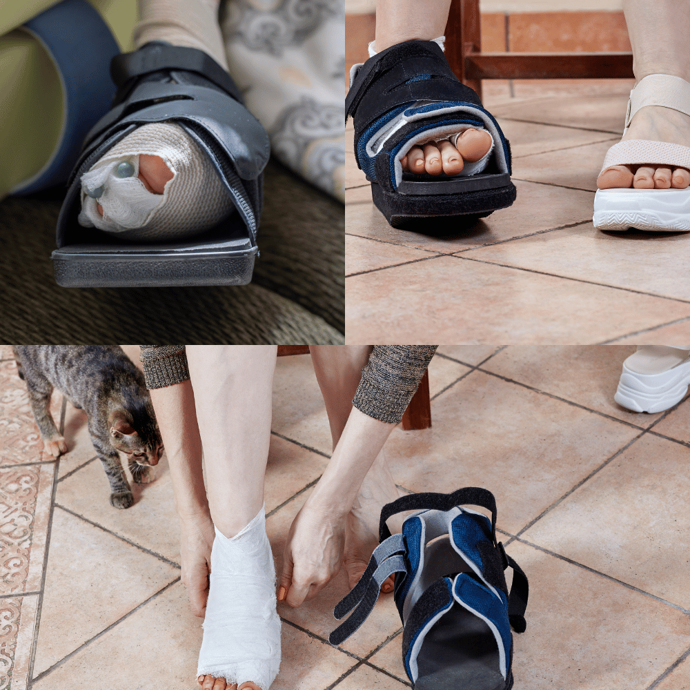 The Top 3 Shoes for After Bunion Surgery